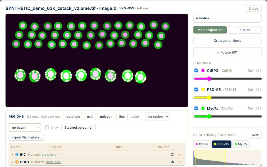A confocal z-stack of cochlear hair cells open in the exOtic image viewer, with a channel per stain